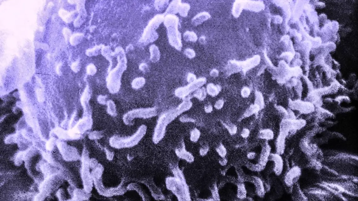 Limfocyt T / Fot. Dr Triche / NATIONAL CANCER INSTITUTE