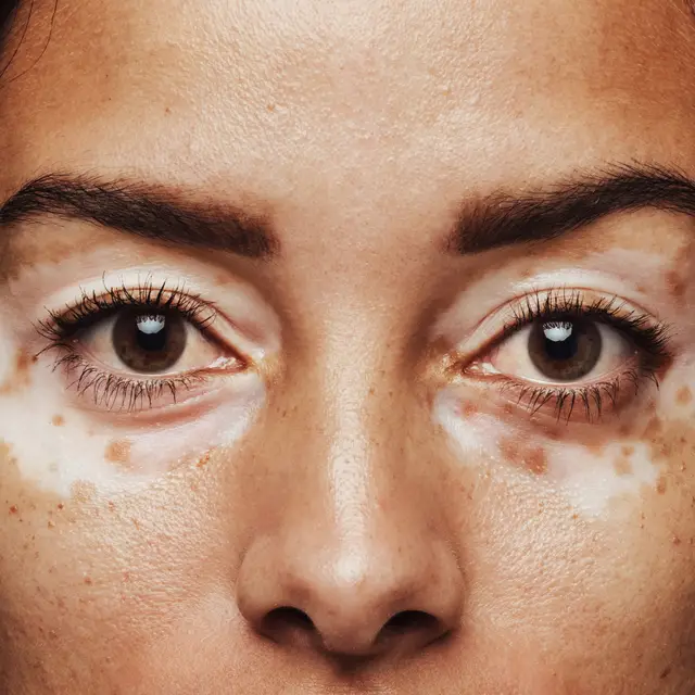 // Jacob Lund / Shutterstock
