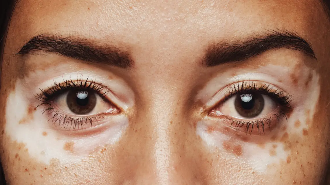 // Jacob Lund / Shutterstock