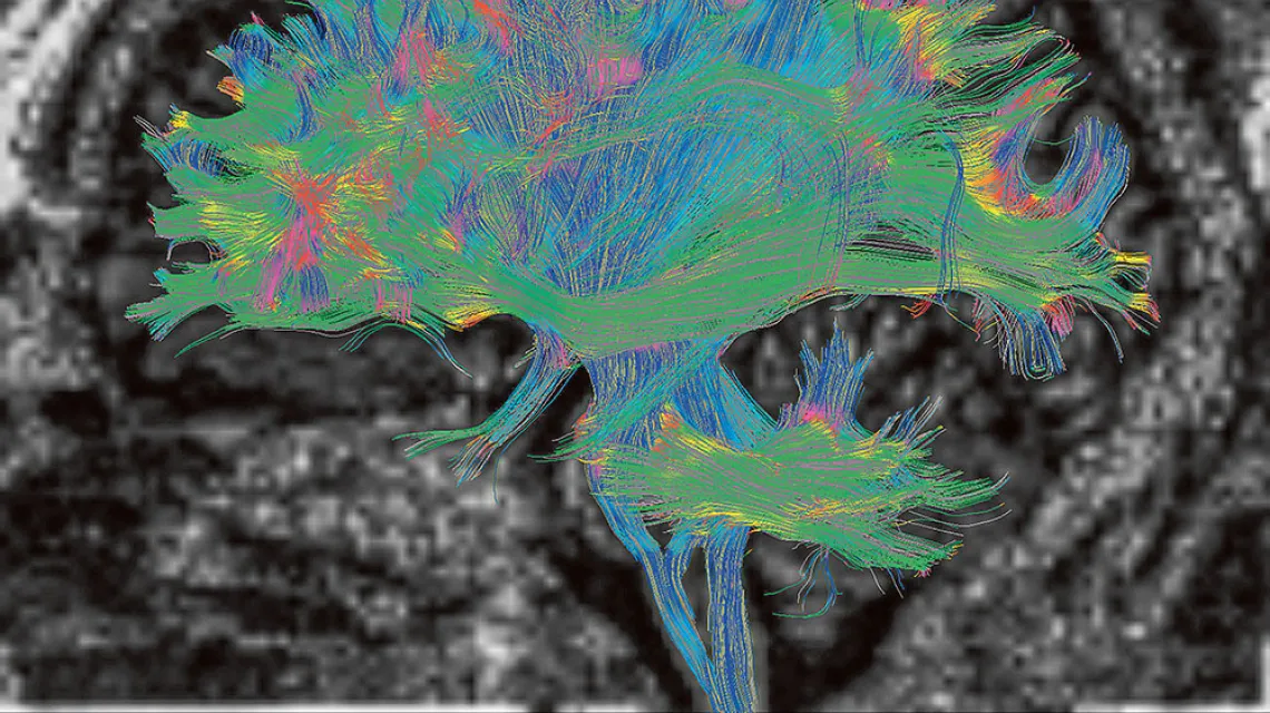 Wynik obrazowania włókien neuronalnych za pomocą tzw. traktografii tensora dyfuzji (ang. DTI). Ta metoda pozwala w nieinwazyjny sposób zbadać, jak łączą się poszczególne części mózgu. / CULTURA CREATIVE RF / ALAMY / BE&W