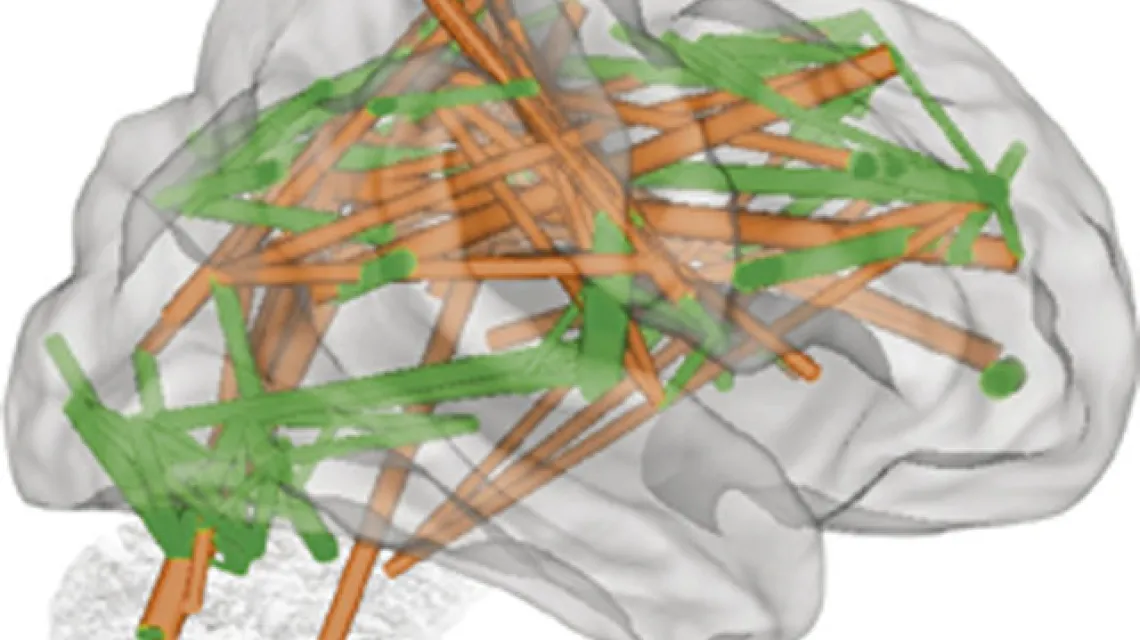 Funkcjonalne połączenia w mózgu: rozwijające się z wiekiem mają kolor pomarańczowy, zanikające – zielony. / 