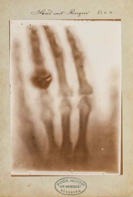 Zdjęcie RTG dłoni pani Anny Berthy Röntgen, 22 grudnia 1895 r. / MARTIJN ZEGEL / TEYLERS MUSEUM