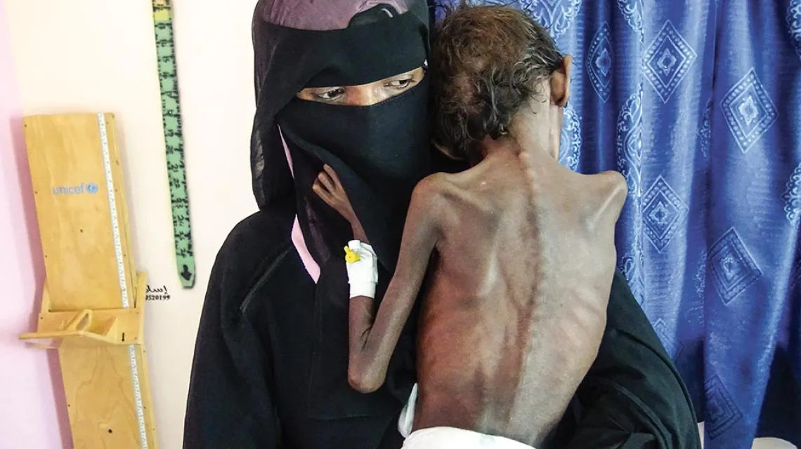 Abdelrahman Manhash (z matką Nadii Nahari) ma 5 lat i cierpi na niedożywienie, które zagraża jego życiu. Zachodni Jemen, 22 listopada 2018 r. / AFP / EAST NEWS