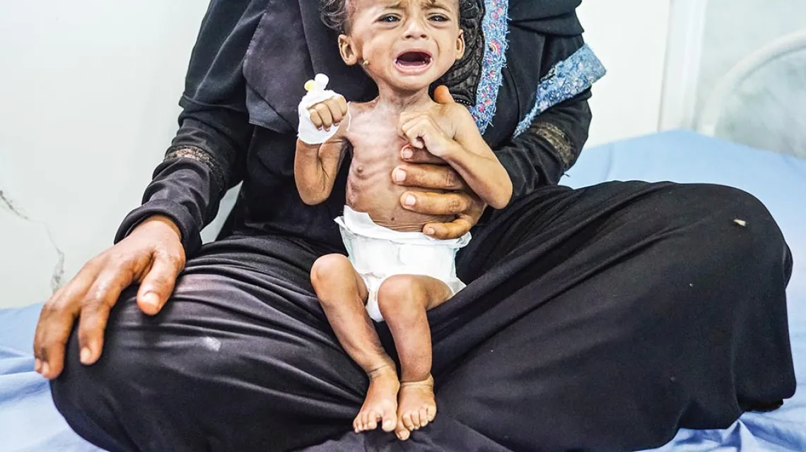 Kiedy przyjęto ją do szpitala w Al-Hudajdzie z objawami skrajnego niedożywienia, czteromiesięczna Saleh ważyła 2,5 kg. Takich jak ona jest dziś w Jemenie ponad 400 tys. Opieka w centrach dożywiania jest bezpłatna, lecz mieszkańców oddalonych miejscowości  / GILES CLARKE / UN OCHA / GETTY IMAGES