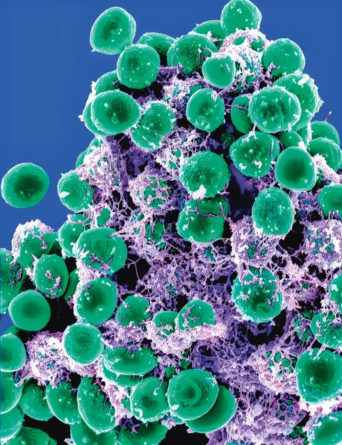 Populacja bakterii gronkowca (Staphylococcus epidermidis) pod mikroskopem elektronowym. / BSIP / GETTY IMAGES
