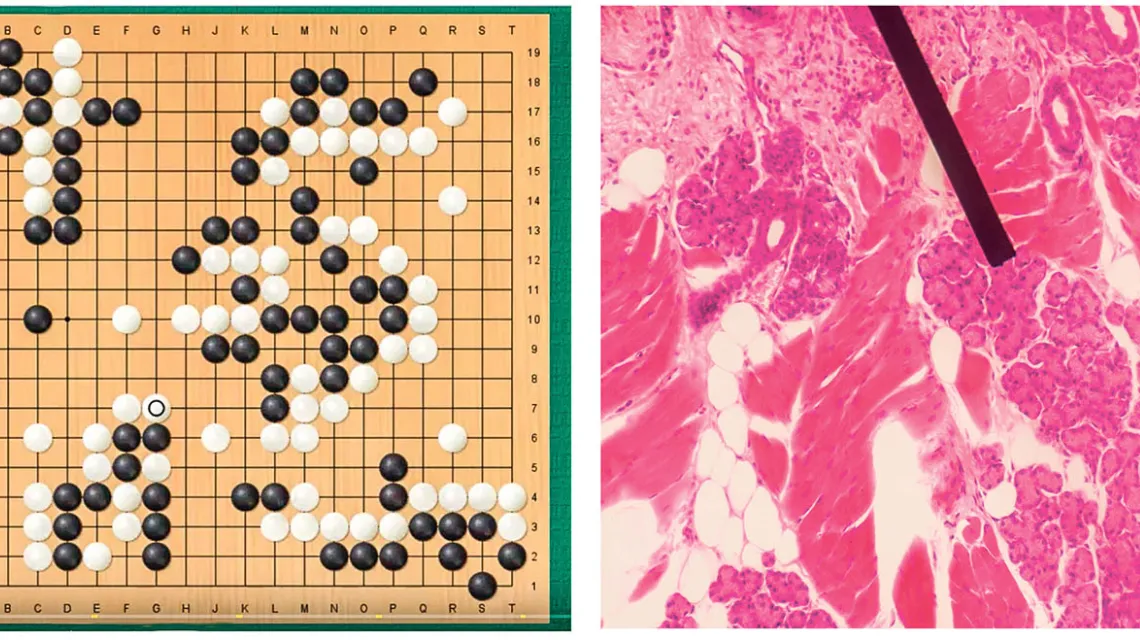 Od lewej: Przebieg meczu AlphaGoMaster kontra AlphaGo Zero (gra czarnymi). Mikroskopowy obraz ludzkiego gruczołu Ebnera. / YOUTUBE.COM // WIKIPEDIA.ORG