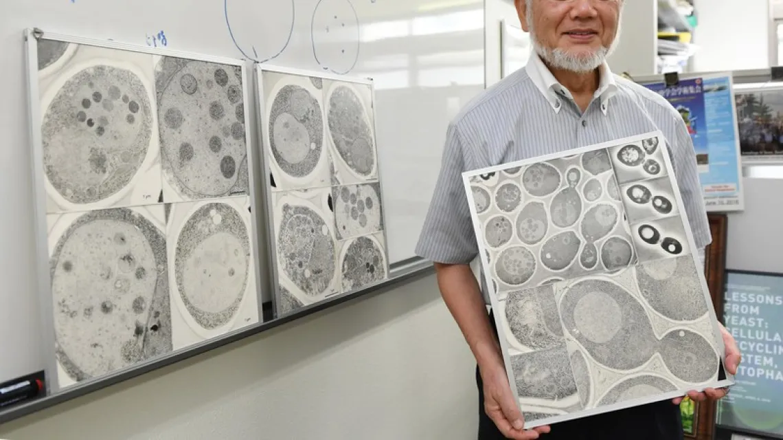 Prof. Ohsumi ze zdjęciami komórek, w których zachodzi proces autofagii / Fot. Kyodo News / EAST NEWS