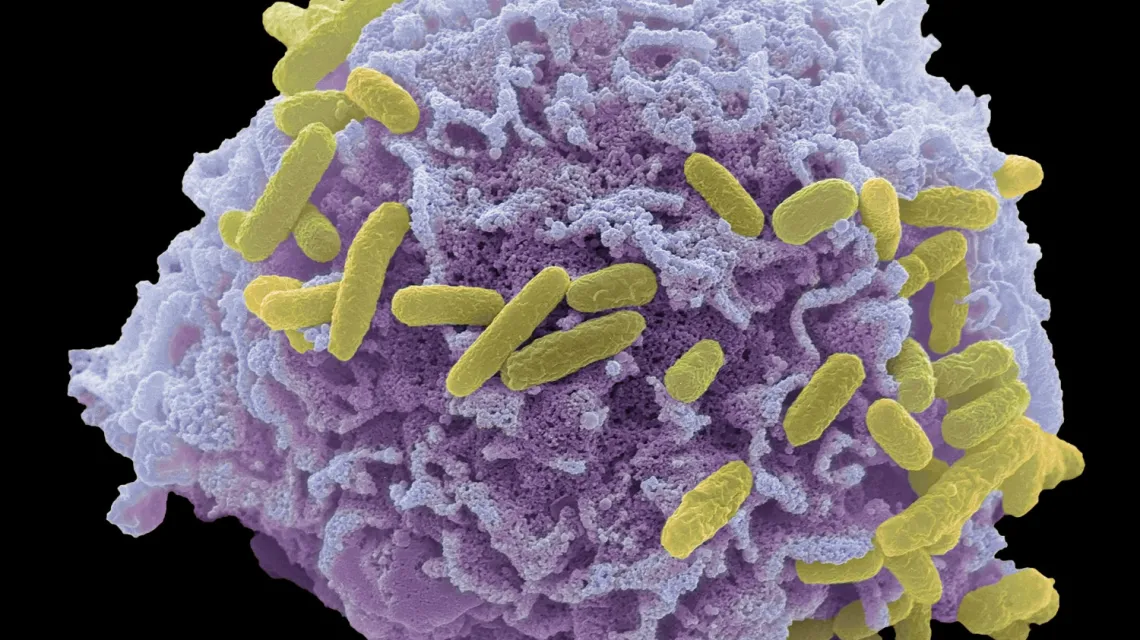 Zakażenie bakteryjne. Bakteria Escherichia coli (kolor żółty) przyczepiona do resztek umierającej komórki / Fot. STEVE GSCHMEISSNER / Science Photo Library / East News / 