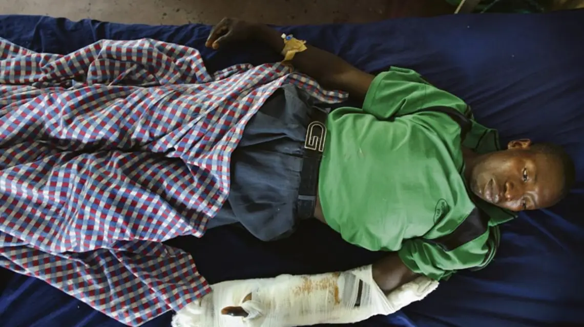 Sebo Pangrasa, jedna z tysięcy cywilnych ofiar wojny we wschodnim Kongo. Goma, 31 lipca 2012 r. / Fot. Phil Moore / AFP / EAS T NEWS
