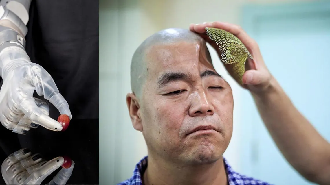 Z lewej: cybernetyczna proteza DEKA Arm System potrafi schwycić nawet delikatne przedmioty. Z prawej: implant kości czaszki przygotowany „na miarę” na drukarce 3D przez lekarzy z Xi’an (Chiny) dla ofiary upadku z trzeciego piętra. / Fot. DARPA, EAST NEWS