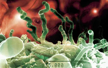 Kolonia nanobakterii w 35 tysięcznym powiększeniu / courtesy www.microscopy-uk.org.uk / 