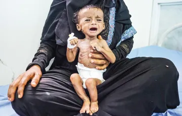 Kiedy przyjęto ją do szpitala w Al-Hudajdzie z objawami skrajnego niedożywienia, czteromiesięczna Saleh ważyła 2,5 kg. Takich jak ona jest dziś w Jemenie ponad 400 tys. Opieka w centrach dożywiania jest bezpłatna, lecz mieszkańców oddalonych miejscowości / GILES CLARKE / UN OCHA / GETTY IMAGES