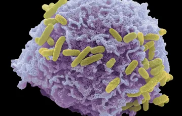 Zakażenie bakteryjne. Bakteria Escherichia coli (kolor żółty) przyczepiona do resztek umierającej komórki / Fot. STEVE GSCHMEISSNER / Science Photo Library / East News / 