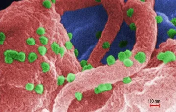 Wirus HIV / Fot. CDC / 