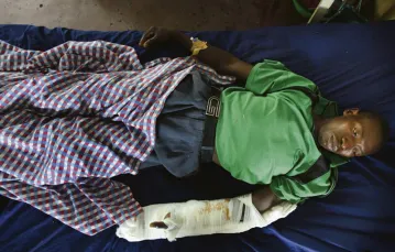 Sebo Pangrasa, jedna z tysięcy cywilnych ofiar wojny we wschodnim Kongo. Goma, 31 lipca 2012 r. / Fot. Phil Moore / AFP / EAS T NEWS