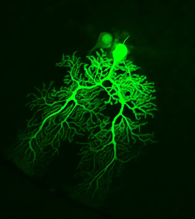 Neuron Purkinjego z móżdżku myszy, jedna z najbardziej rozgałęzionych komórek układu nerwowego // cellimagelibrary.org